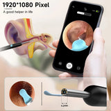 Smart Ear Cleaner Camera