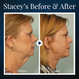 BeautyRest+ Sleeping V-Face Beauty Device - beumoonshop