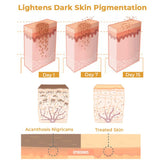 GFOUK™ NigriCare Therapy Drops - beumoonshop