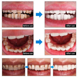 Teeth Whitening Mousse Toothpaste - beumoonshop