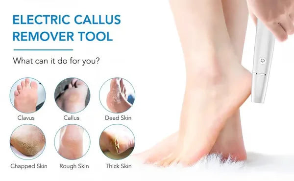 Smooth Feet Magic Tool