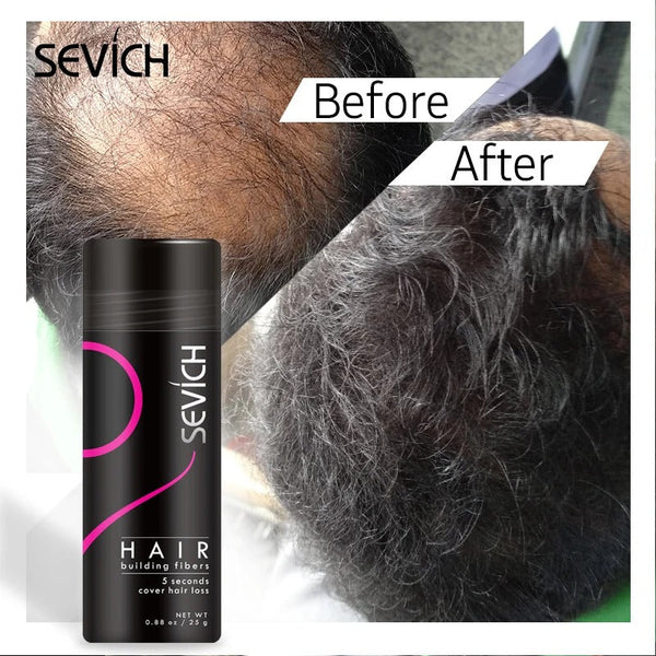 Sevich Instant Hair Volume Booster