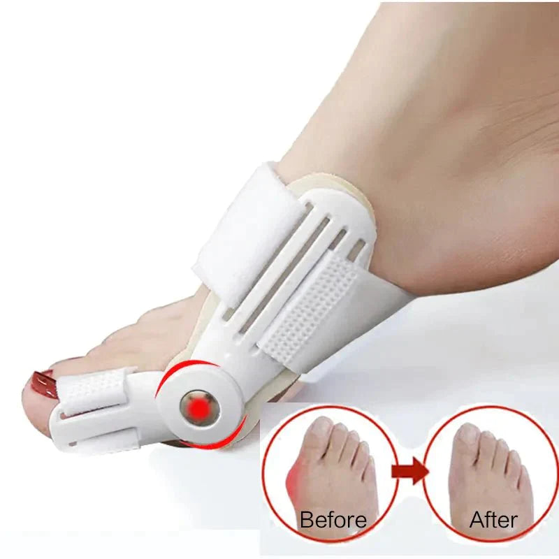 (1+1 FREE) Bunion Relief Splint - beumoonshop