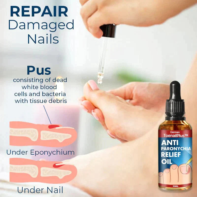 German ToenailPlus™ Anti Paronychia Relief Oil - beumoonshop