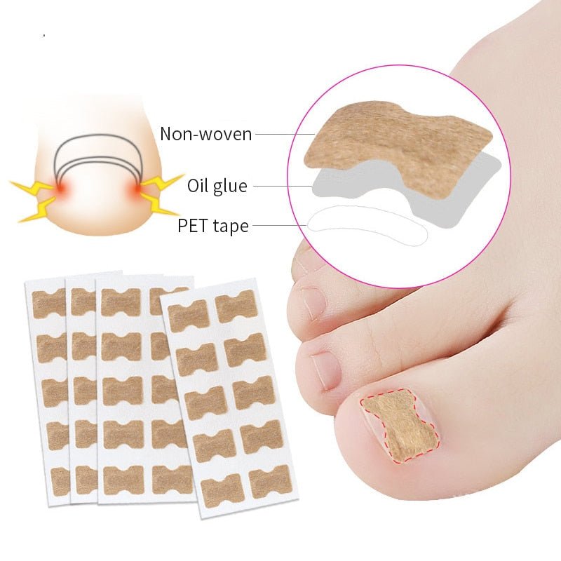 Painless Toenail Patch - ToenailExpress™ - beumoonshop