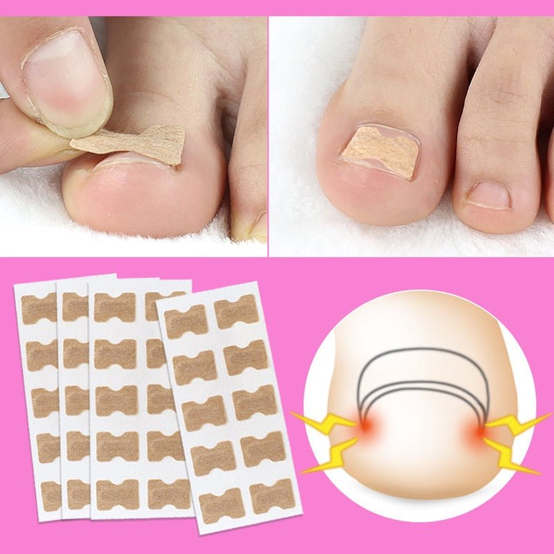 Painless Toenail Patch - ToenailExpress™ - beumoonshop