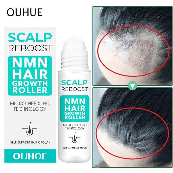 Rapid Hair Growth Serum Roller - beumoonshop