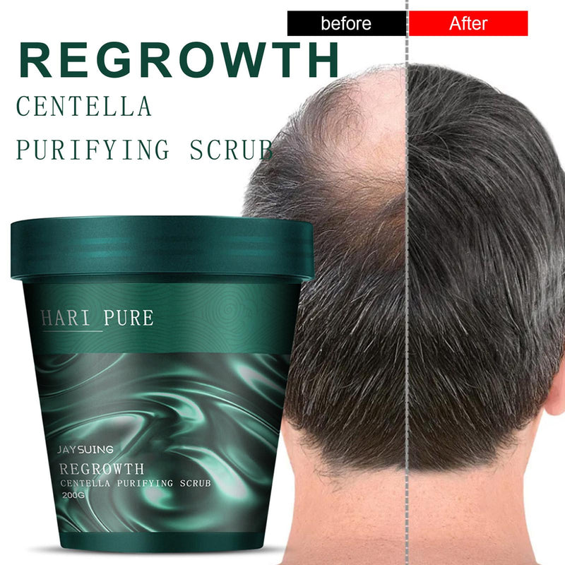 Regrowth & Anti-dandruff Shampoo - beumoonshop