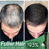 Regrowth Organic Hair Serum Roller - beumoonshop
